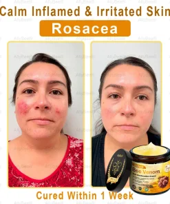 AllyBee™ Skin Treatment Cream