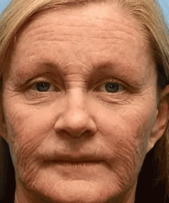 AllyBee™ Skin Treatment Cream