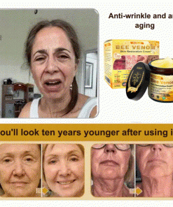 AllyBee™ Skin Treatment Cream