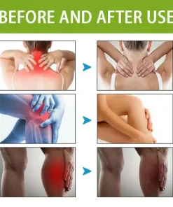 BeeTherapy™ Bee Venom Pain Relief Cream