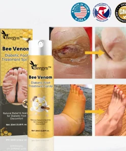 Beegyn™ Bee Venom Diabetic Foot Treatment Spray