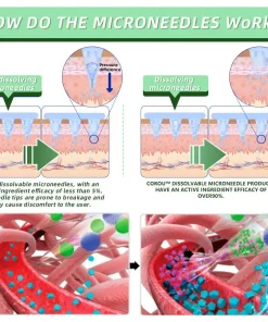 COROU™ SMGT-GLP-1 Microneedle Patch