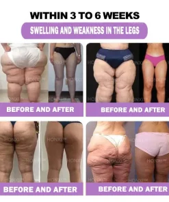 HONXI™ Turmeric and Emu Oil Anti-Inflammatory Slimming Foot Soak Pearls