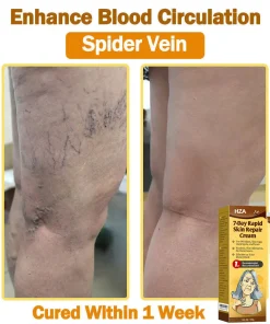 HZA®𝟕-𝐃𝐚𝐲 𝐑𝐚𝐩𝐢𝐝 𝐒𝐤𝐢𝐧 𝐑𝐞𝐩𝐚𝐢𝐫 𝐂𝐫𝐞𝐚𝐦