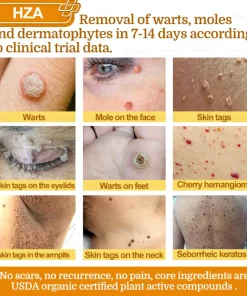 HZA®𝟕-𝐃𝐚𝐲 𝐑𝐚𝐩𝐢𝐝 𝐒𝐤𝐢𝐧 𝐑𝐞𝐩𝐚𝐢𝐫 𝐂𝐫𝐞𝐚𝐦