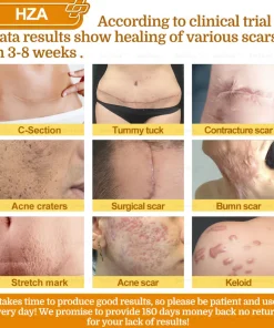 HZA®𝟕-𝐃𝐚𝐲 𝐑𝐚𝐩𝐢𝐝 𝐒𝐤𝐢𝐧 𝐑𝐞𝐩𝐚𝐢𝐫 𝐂𝐫𝐞𝐚𝐦