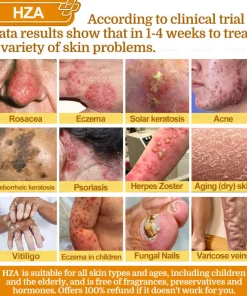 HZA®𝟕-𝐃𝐚𝐲 𝐑𝐚𝐩𝐢𝐝 𝐒𝐤𝐢𝐧 𝐑𝐞𝐩𝐚𝐢𝐫 𝐂𝐫𝐞𝐚𝐦