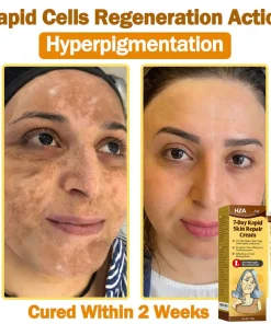 HZA®𝟕-𝐃𝐚𝐲 𝐑𝐚𝐩𝐢𝐝 𝐒𝐤𝐢𝐧 𝐑𝐞𝐩𝐚𝐢𝐫 𝐂𝐫𝐞𝐚𝐦