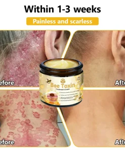 HZA™ Bee Toxin Skin Treatment Cream