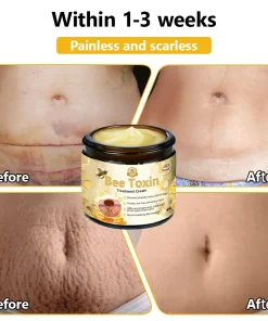 HZA™ Bee Toxin Skin Treatment Cream