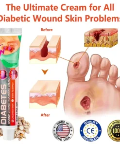 HZA™ Diabetes Wound Strong Treatment Cream