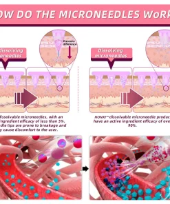 HonXi® Nano Microneedle Slimming Patch