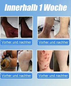 JORONDY® VitaGluco Diabetes Treatment Cream