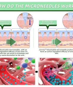 Jorondy™ SMGT-GLP-1 Nano Microneedle Patch