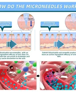 Lmipki® NIDDK-Tirzepatide Nano Microneedle Patch