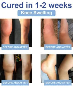 Lotmay™ Magnesium Pain Healing Bone Cream