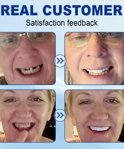 Nurbini™ Advanced Customized Full Denture Set