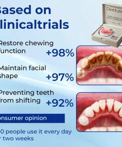 Nurbini™ Advanced Customized Full Denture Set