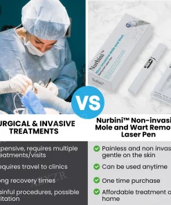 Nurbini® Non-invasive Mole and Wart Removal Laser Pen
