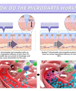 Oyikey® 𝐒𝐍𝐀𝐂-𝐆𝐋𝐏-𝟏 𝐍𝐚𝐧𝐨 𝐌𝐢𝐜𝐫𝐨𝐧𝐞𝐞𝐝𝐥𝐞 𝐏𝐚𝐭𝐜𝐡