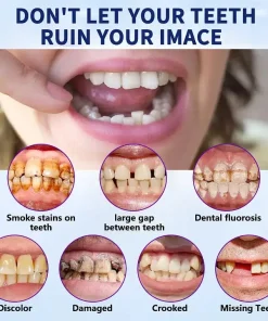 QIAWI ™-🦷Advanced Customized Full Denture Set