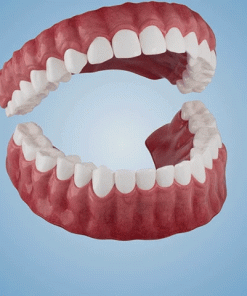 QIAWI ™-🦷Advanced Customized Full Denture Set
