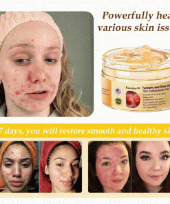 Raindew™ Turmeric and Emu Oil Skin Antibacterial Gel