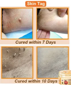 Raindew™ Turmeric and Emu Oil Skin Antibacterial Gel