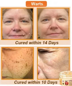 Raindew™ Turmeric and Emu Oil Skin Antibacterial Gel