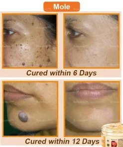 Raindew™ Turmeric and Emu Oil Skin Antibacterial Gel