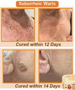 Raindew™ Turmeric and Emu Oil Skin Antibacterial Gel