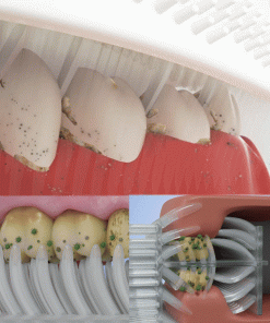 Remifa™ SpeedySmile EZBrush 360 U-Shape Toothbrush