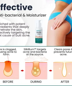 SilkiBum™ Butt Skin Treatment Cream