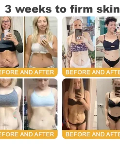 TLOPA® Botox Bee Venom Anti-Aging Firming Gel