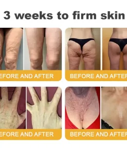 TLOPA® Botox Bee Venom Anti-Aging Firming Gel