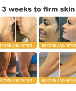 TLOPA® Botox Bee Venom Anti-Aging Firming Gel