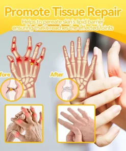 𝐒𝐓𝐃𝐄𝐈®𝐁𝐨𝐭𝐮𝐥𝐢𝐧𝐮𝐦 𝐓𝐨𝐱𝐢𝐧 & 𝐁𝐞𝐞 𝐕𝐞𝐧𝐨𝐦 𝐏𝐚𝐢𝐧-𝐑𝐞𝐥𝐢𝐞𝐟 𝐁𝐨𝐧𝐞 𝐇𝐞𝐚𝐥𝐢𝐧𝐠 𝐂𝐫𝐞𝐚𝐦