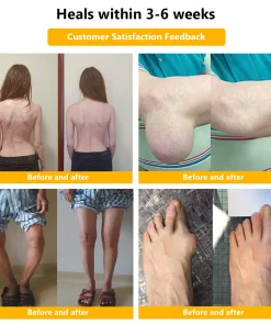 𝐒𝐓𝐃𝐄𝐈®𝐁𝐨𝐭𝐮𝐥𝐢𝐧𝐮𝐦 𝐓𝐨𝐱𝐢𝐧 & 𝐁𝐞𝐞 𝐕𝐞𝐧𝐨𝐦 𝐏𝐚𝐢𝐧-𝐑𝐞𝐥𝐢𝐞𝐟 𝐁𝐨𝐧𝐞 𝐇𝐞𝐚𝐥𝐢𝐧𝐠 𝐂𝐫𝐞𝐚𝐦