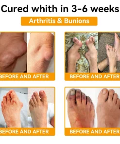 𝐒𝐓𝐃𝐄𝐈®𝐁𝐨𝐭𝐮𝐥𝐢𝐧𝐮𝐦 𝐓𝐨𝐱𝐢𝐧 & 𝐁𝐞𝐞 𝐕𝐞𝐧𝐨𝐦 𝐏𝐚𝐢𝐧-𝐑𝐞𝐥𝐢𝐞𝐟 𝐁𝐨𝐧𝐞 𝐇𝐞𝐚𝐥𝐢𝐧𝐠 𝐂𝐫𝐞𝐚𝐦