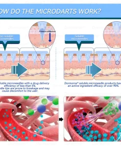 𝑫𝒐𝒓𝒎𝒐𝒓𝒏𝒂® 𝑫𝒊𝒂𝒃𝒆𝒕𝒆𝒔 𝑨𝒖𝒔𝒕𝒓𝒂𝒍𝒊𝒂-𝑻𝒊𝒓𝒛𝒆𝒑𝒂𝒕𝒊𝒅𝒆 𝑵𝒂𝒏𝒐 𝑴𝒊𝒄𝒓𝒐𝒏𝒆𝒆𝒅𝒍𝒆 𝑷𝒂𝒕𝒄𝒉