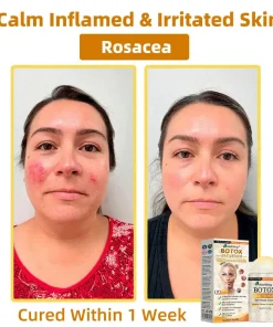 𝐀𝐞𝐞𝐡𝐟𝐞𝐧𝐠® 𝐁𝐎𝐓𝐎𝐗 𝐁𝐞𝐞 𝐕𝐞𝐧𝐨𝐦 𝐒𝐤𝐢𝐧 𝐑𝐞𝐩𝐚𝐢𝐫 𝐂𝐫𝐞𝐚𝐦