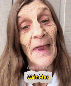 𝐀𝐞𝐞𝐡𝐟𝐞𝐧𝐠® 𝐁𝐎𝐓𝐎𝐗 𝐁𝐞𝐞 𝐕𝐞𝐧𝐨𝐦 𝐒𝐤𝐢𝐧 𝐑𝐞𝐩𝐚𝐢𝐫 𝐂𝐫𝐞𝐚𝐦