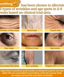 𝐀𝐞𝐞𝐡𝐟𝐞𝐧𝐠® 𝐁𝐎𝐓𝐎𝐗 𝐁𝐞𝐞 𝐕𝐞𝐧𝐨𝐦 𝐒𝐤𝐢𝐧 𝐑𝐞𝐩𝐚𝐢𝐫 𝐂𝐫𝐞𝐚𝐦