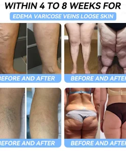 𝐷𝑜𝑟𝑚𝑜𝑟𝑛𝑎® 𝑁𝐻𝑀𝑅𝐶-𝑇𝑖𝑟𝑧𝑒𝑝𝑎𝑡𝑖𝑑𝑒 𝑁𝑎𝑛𝑜 𝑀𝑖𝑐𝑟𝑜𝑛𝑒𝑒𝑑𝑙𝑒 𝑃𝑎𝑡𝑐ℎ