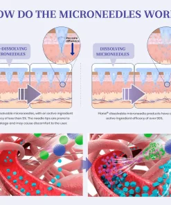 𝗛𝗼𝗻𝘅𝗶® 𝗡𝗜𝗗𝗗𝗞-𝗧𝗶𝗿𝘇𝗲𝗽𝗮𝘁𝗶𝗱𝗲 𝗡𝗮𝗻𝗼 𝗠𝗶𝗰𝗿𝗼𝗻𝗲𝗲𝗱𝗹𝗲 𝗣𝗮𝘁𝗰𝗵