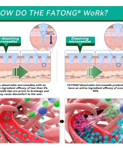 𝑭𝑨𝑻𝑶𝑵𝑮® 𝑺𝑴𝑮𝑻-𝑮𝑳𝑷-1 𝑵𝒂𝒏𝒐 𝑴𝒊𝒄𝒓𝒐𝒏𝒆𝒆𝒅𝒍𝒆 𝑺𝒍𝒊𝒎𝒎𝒊𝒏𝒈 𝑷𝒂𝒕𝒄𝒉