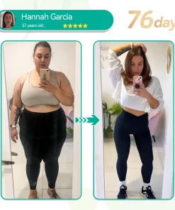 𝑭𝑨𝑻𝑶𝑵𝑮® 𝑺𝑴𝑮𝑻-𝑮𝑳𝑷-1 𝑵𝒂𝒏𝒐 𝑴𝒊𝒄𝒓𝒐𝒏𝒆𝒆𝒅𝒍𝒆 𝑺𝒍𝒊𝒎𝒎𝒊𝒏𝒈 𝑷𝒂𝒕𝒄𝒉