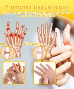 ADNOON™ Botulinum Toxin & Bee Venom Pain-Relief Bone Healing Cream