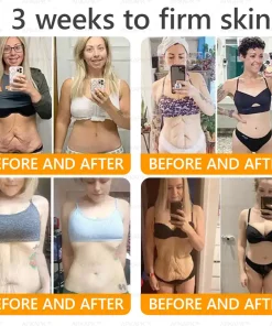 APKAPK® Bee Venom Botox Skin Renewal Cream