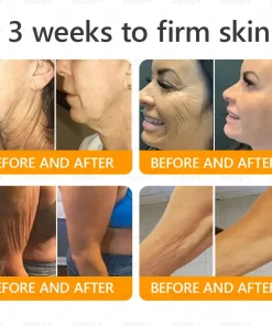 APKAPK® Bee Venom Botox Skin Renewal Cream